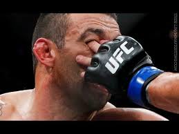 And if you can believe this one, because i can't f—king believe it, ufc president dana white reported i've been dominate for 12 years tonight was my turn to lose!!!! Worst Injuries From Eye Pokes In The Ufc Youtube
