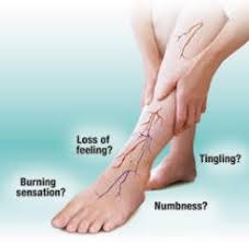 Image result for Peripheral Neuropathy