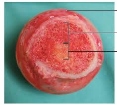 The red bone marrow can attribute its red color to the presence of hemoglobin while the yellow bone marrow has a distinct yellowish color due to the. Bone Marrow Physiopedia