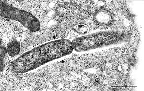 Image result for Rickettsiae