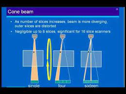 Physics And Technology Of Multislice Ct Youtube