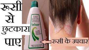 Dermatologist and hair care experts say that the best treatment for dandruff are antifungal medications. Best Treatment For Dandruff Hair Fall Use Selsun Anti Dandruff Treatment Shampoo à¤¬ à¤² à¤• à¤° à¤¸ Youtube