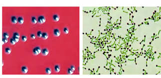 The test is a simple procedure. Corynebacterium Diphtheriae The Causative Agent Of The Diphtheria Download Scientific Diagram