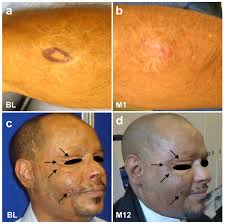 Perspective: Why and How Ubiquitously Distributed, Vascular-Associated,  Pluripotent Stem Cells in the Adult Body (vaPS Cells) Are the Next  Generation of Medicine