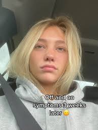 Swollen Eye from Mono