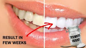 Are your suffering from teeth discoloration or pale teeth? Using Baking Soda To Whiten Teeth Teeth Whitening Reviews Youtube