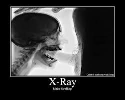 251px x 201px - Xray deepthroat Album - Top adult videos and photos