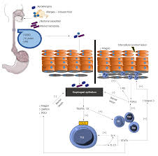 Eosinophilic Esophagitis Current Concepts In Diagnosis And