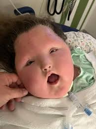 Thanks for your prayers today. As they have been running tests, giving 2  units of blood for low hemoglobin and dispensing fluids as versus regular  feedings due to a pending endoscopy....today became