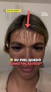 Quería ser modelo y tenía la sonrisa perfecta para ello. Pero su ex novio  se vengó cobardemente quitándole los sueños. La convirtió en un fenómeno y  creyó que así destruiría su vida