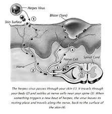 Image result for genital herpes