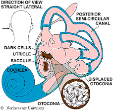 Lee n.h., ban j.h., lee k.c., kim s.m. Bppv Benign Paroxysmal Positional Vertigo