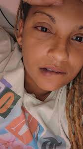 Go see this specialist here soon see what they talking about! My eye hurts  so bad, can barley see out of it and i constantly feel like something is  scratching my eye