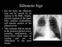 Pin By Brenda Van Zyl On Medical Medical Radiography Nuclear Medicine Medical Mnemonics