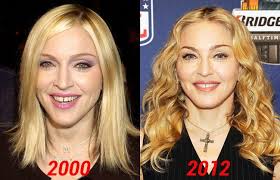 The stigma surrounding plastic surgery is disappearing as more mothers share their experiences, and why surg. Madonna Plastic Surgery Good Procedures Or Epic Fail