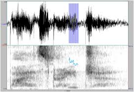 Image result for Whispered Voice Testing