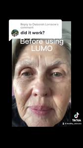 Replying to @Deborah Lorraine yes the LUMO definitely works