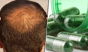 Bind to the receptors of steroid hormones that stunt hair growth. Balding Treatment Best Supplements And Foods To Prevent Hair Loss Express Co Uk