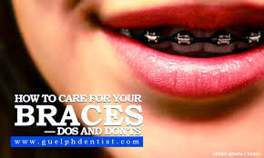 I understand being tempted to cut your braces wire with scissors as i was a brace face myself for 5 years straight. How To Care For Your Braces Dos And Don Ts Guelph Dentist