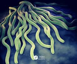 Image result for Spirochete