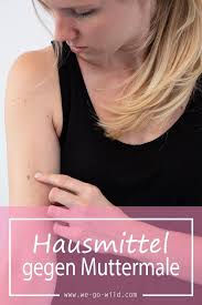 Wie Entstehen Muttermale Alles Rund Um Das Muttermal Muttermal Leberfleck Entfernen Leberfleck