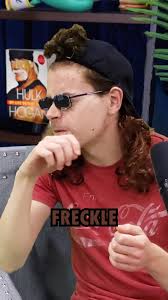 Theo Von Ireland Freckles