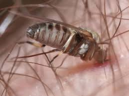 Le film avait engendré 70 millions de dollars à travers le monde pour un budget presque cinq fois moindre. Des Inflammations Douloureuses A Cause D Une Petite Mouche Mysterieuse En Lorraine Le Lorrain