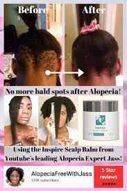Inspire Scalp Balm Alopecia Free Shop Promote Healthy Hair Growth Natural Hair Styles Healthy Hair Tips