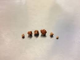 Vitamin C Does Not Cause Kidney Stones Kidney Stones Kidney Treatment Stone