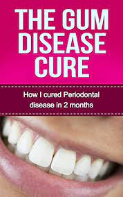 Amazon.com: The Gum Disease Cure: How I Cured Periodontal Disease In 2  Months (Gum Disease Periodontal Disease Periodontitis Receeding Gums) Ebook  : Shaham, Guy: Kindle Store