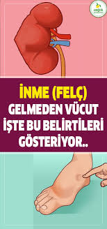 Inme Gecirmeden 24 Saat Once Vucut Bu Belirtileri Gosteriyor Felc Saglik Inme Kadin Pratik Health Memes Movie Posters