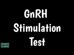 Image result for GnRH Stimulation Test