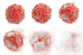 Endometrial cancer is a type of cancer that begins in the uterus. Endometrial Cancer Drug Loaded Nanoparticles Destroy Tumor Cells