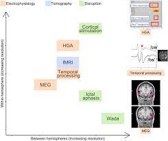 Jun 25, 2019 · the blind mans faith in jesus is what allowed him to be healed. Contributions Of Electrophysiology For Identifying Cortical Language Systems In Patients With Epilepsy Epilepsy Behavior