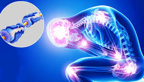 Do you like this video? Sindrome Di Guillain Barre Che Cos E E Come Trattarla Mercosul Saude