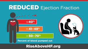 Ejection Fraction Heart Failure Measurement American Heart Association