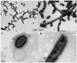 A species of considerable medical importance. Microorganisms Free Full Text Aztreonam Lysine Increases The Activity Of Phages E79 And Phikz Against Pseudomonas Aeruginosa Pa01