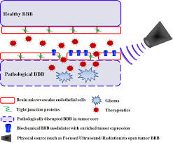 Maybe you would like to learn more about one of these? Pharmaceutics Free Full Text Blood Brain Barrier Modulation To Improve Glioma Drug Delivery Html