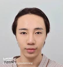 ศัลยกรรมเกาหลีของนนท์อินทนนท์: รีวิวและรายละเอียด