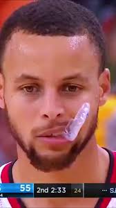 Mouth Guards Curry