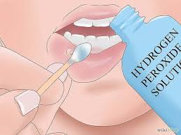 Biting The Inside Of Your Cheek Treatment How To Remove A Mouth Ulcer Mouth Ulcers Canker Sore Ulcer Remedies Mouth