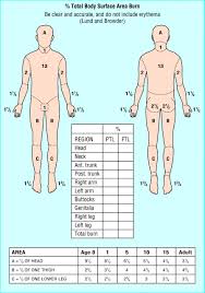 Faithful Rule Of Nines Diagram Rule Of 9s Burn Chart Child