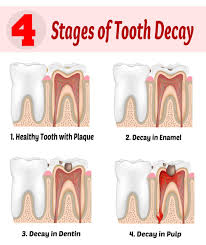 Check spelling or type a new query. How Much Does It Cost To Get Wisdom Teeth Removed Arxiusarquitectura
