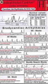 cardiac arrhythmia and ecg medical pocket card set