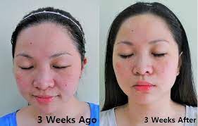 You'll see benefits by using these for just 20 minutes, twice a week, making me time a lot easier to find. Review Journey To Radiant Skin With Mary Kay Melacep Plus Luminous System Let S Roll With Carol