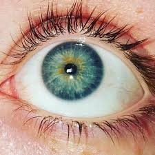 Bright Eyes Central Heterochromia Eye Shadow Application Heterochromia