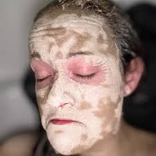 Why are mushrooms growing in my garden after compost application?