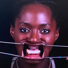 Fundraiser by Dwana Jacob : 12 Years, 1 Last Chance — Help Me Get My Smile  Back