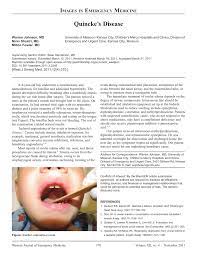 Pdf Quincke S Disease
