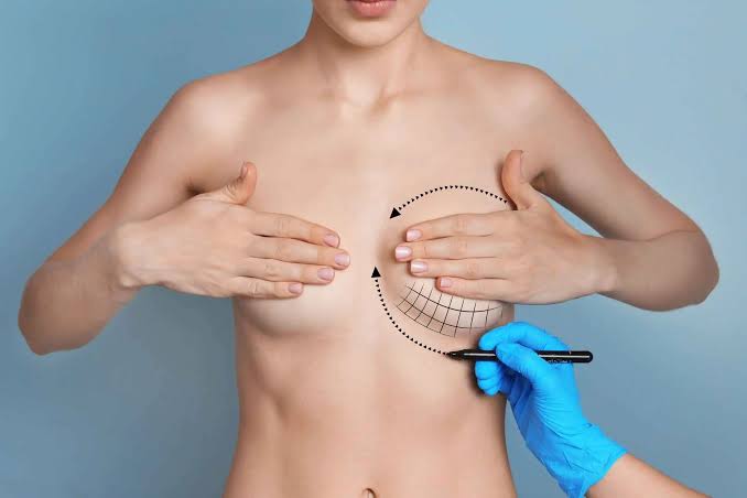 Silicone Breast Implants | Riyadh KSA | Cost & Prices